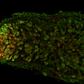 Medicago truncatula, plant root nodule under a microscope C Isidro Abreu, IronFeRhizo project