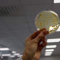 Petri dish containing a disease culture