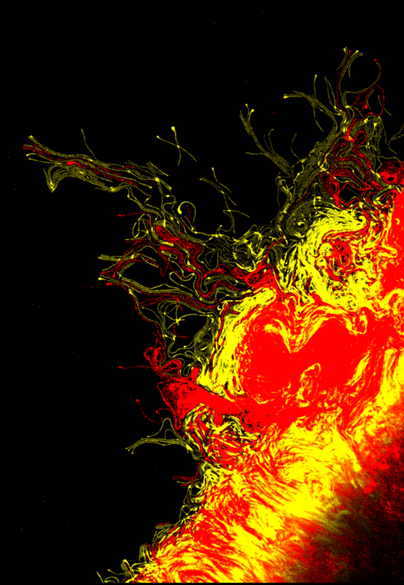 A false-colour microscope image of a lung infected with Pseudomonas aeruginosa