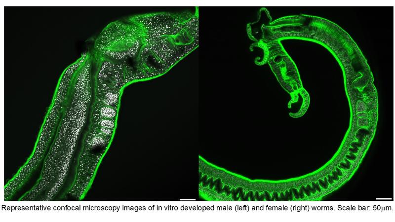 Confocal microscope image of parasitic worms