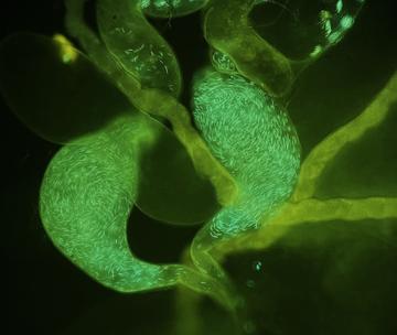 Sperm tagged with Green fluorescent protein in the testes and seminal vesicles (male sperm storage organs) of a male Drosophila fruit fly