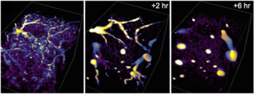 Light sheet imaging of Dictyostelium development embedded in a gel