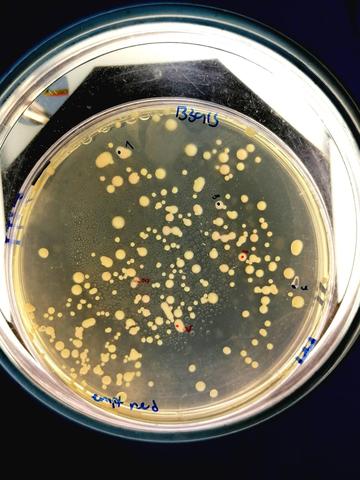 Bacterial colonies growing on an agar plate