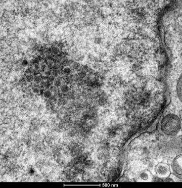 em image of mareks disease virus particles replicating in the nucleus of the infected cell
