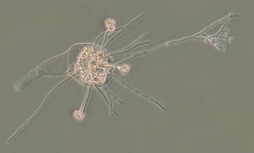Infected rotifer infected rotifer