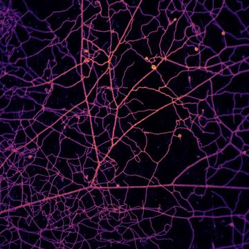 microscopic image of network formed by the arbuscular mycorrhizal fungi rhizophagus irregularis