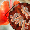 Lung and Pseudomonas aeruginosa bacteria