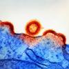 HIV-1 Virus Particles Transmission electron micrograph of HIV-1 virus particles (colourised red/yellow) replicating from an HIV-infected H9 T-cell (blue)