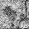 em image of mareks disease virus particles replicating in the nucleus of the infected cell